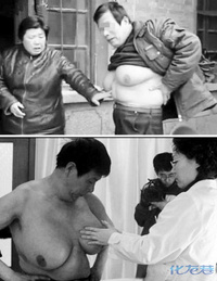 青春期女孩子<em>胸部发育不良</em>怎么办?女孩发育三