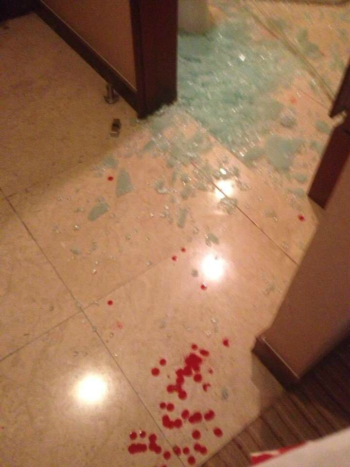 当时住的酒店,为了去打楼下前台电话,房间里地上一条都是血迹.