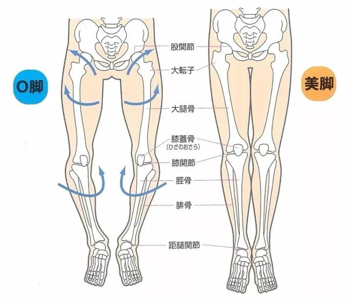 排除结构性问题,如果是 功能性问题导致的腿型不好怎么办呢?