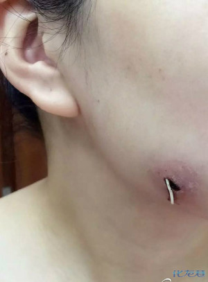 登录/注册后可看大图