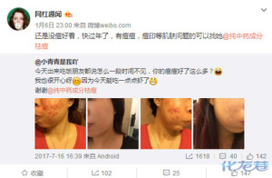 登录/注册后可看大图