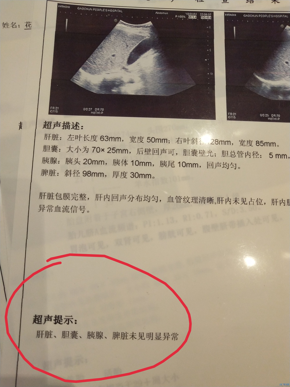 关于我的9个月孩子胎死腹中,武进医院的官方回复,我有