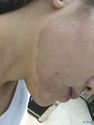登录/注册后可看大图