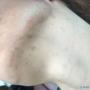 登录/注册后可看大图