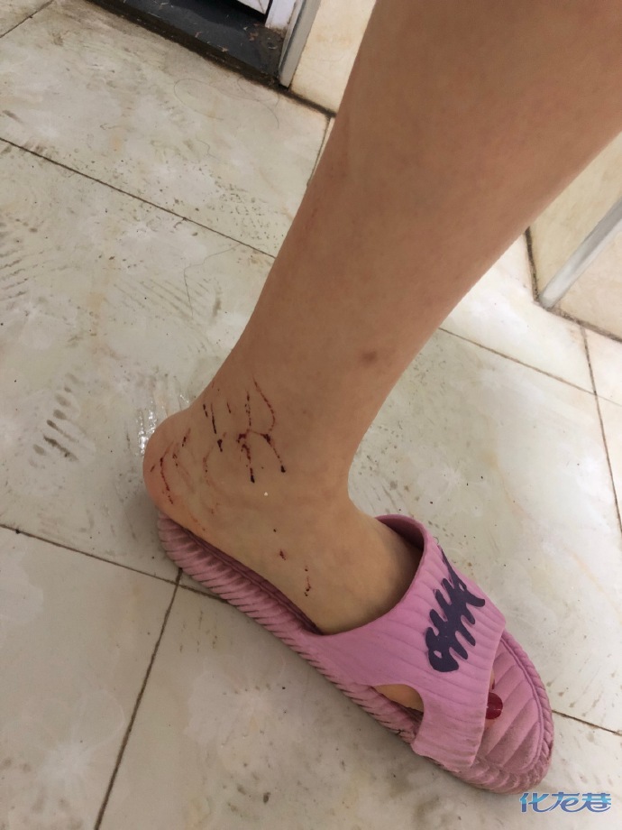 尿浴,虐阴…一女m微博曝光收费约调教,结果被男s用数据线捅成重伤