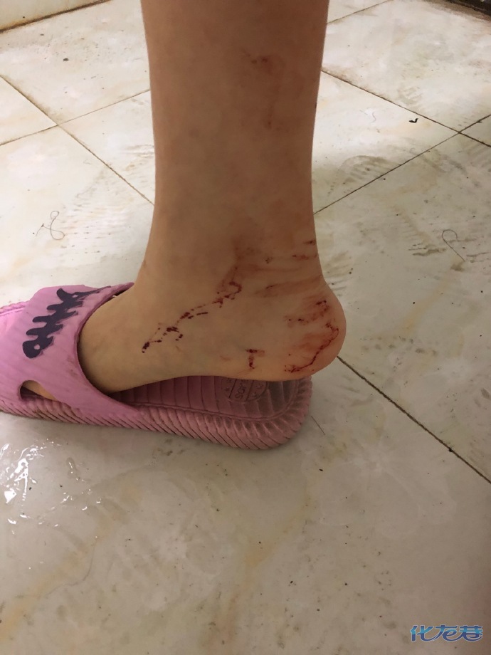 尿浴,虐阴…一女m微博曝光收费约调教,结果被男s用数据线捅成重伤