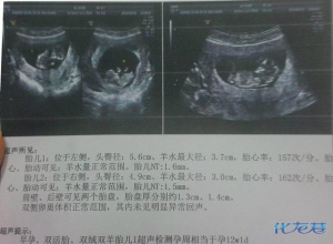 登录/注册后可看大图