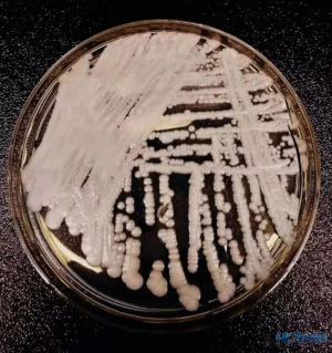 中国确诊18例超级真菌感染,致死率达60%!浙江