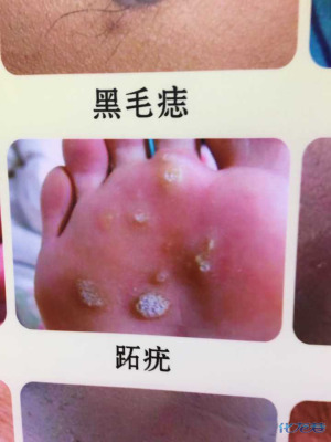 登录/注册后可看大图
