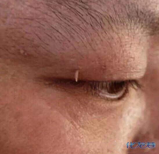 发现脖子上长一些凸起的