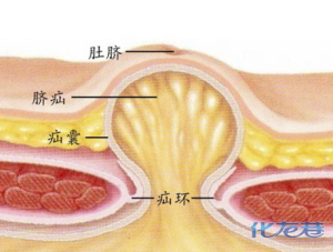 (已结束)市四院腹壁疝外科主任兼胃肠外科副主任李岩