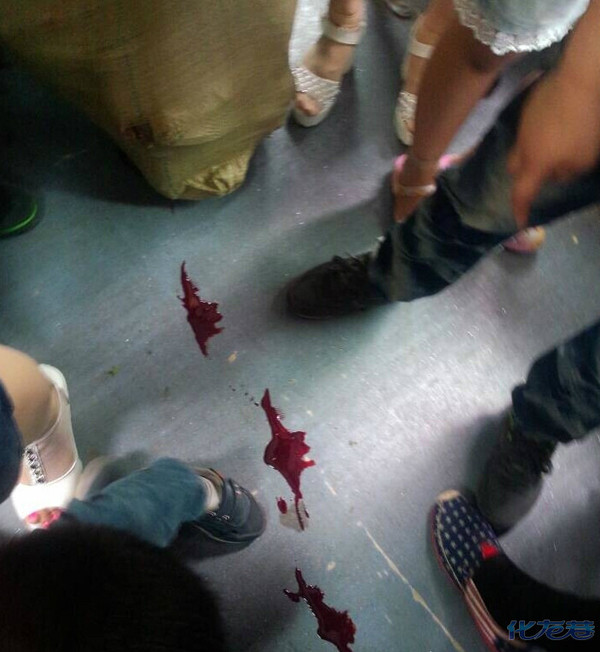10路车上一老大爷突然脚飙血了,地上都是血,就是被人推了撞了一下