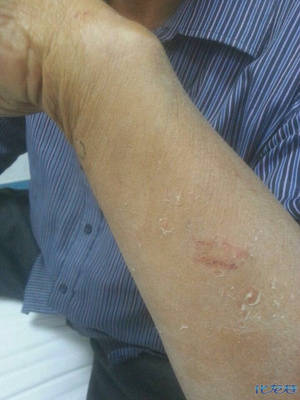 金沙公司丧尽天良,泯灭良知!竟然殴打两位七旬