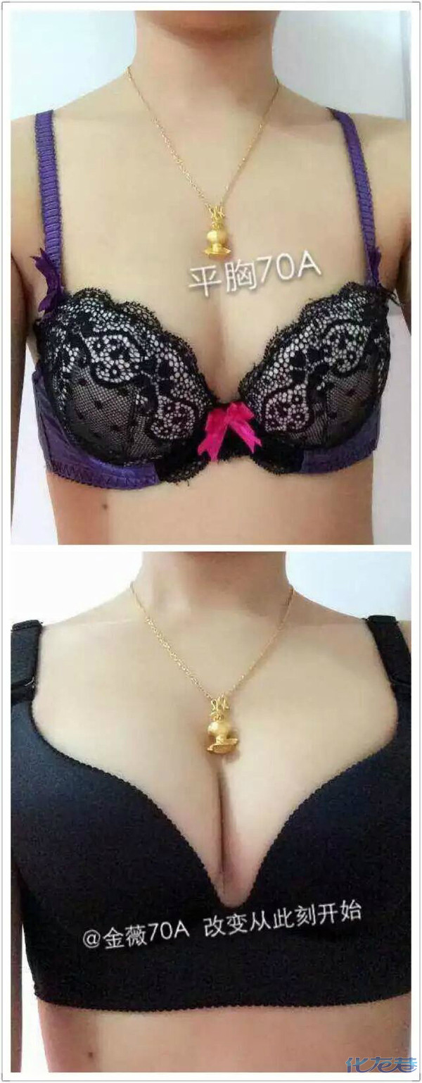 <em>金薇</em>无钢圈<em>文胸</em>招<em>全国</em>各级代理 - 手机化龙巷