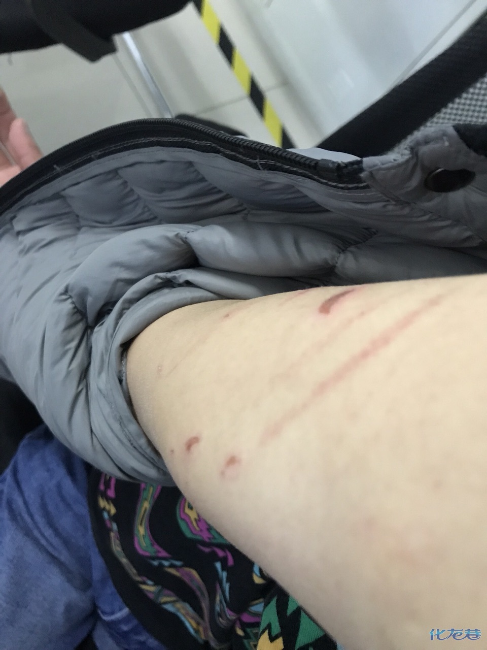 这些伤算是家暴吗?一个男的是不是太委屈了!