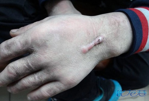 男子遭黑作坊囚禁18年获救,现在不知今夕是何年,有图有真相